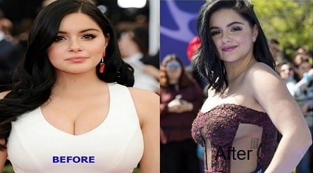 A before and after picture of Ariel Winter showing her changing body.